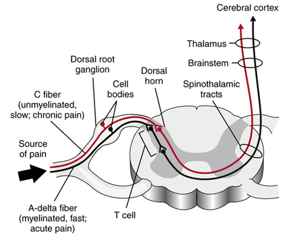 통증 수용기 A-delta 섬유와 C 섬유와 척수의 후각 간의 경로.